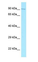 JMY antibody Western Blot of Fetal Lung.