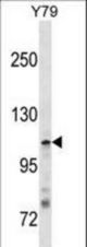 JMY Antibody western blot of Y79 cell line lysates (35 ug/lane). The JMY antibody detected the JMY protein (arrow).