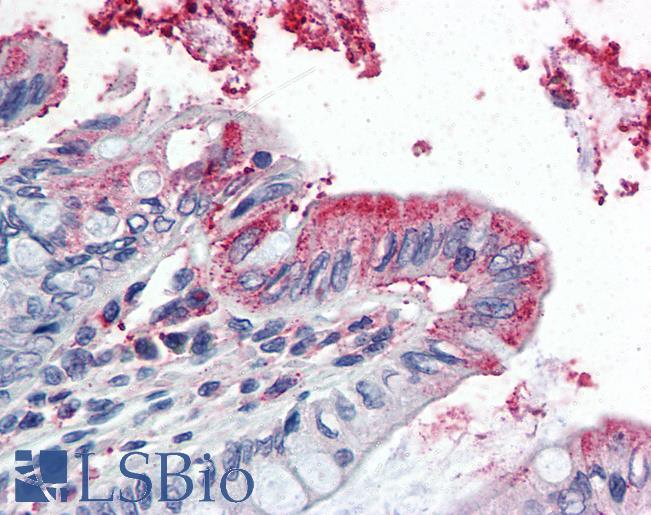 Anti-GPX3 antibody IHC of human colon. Immunohistochemistry of formalin-fixed, paraffin-embedded tissue after heat-induced antigen retrieval. Antibody LS-B3036 concentration 5 ug/ml.