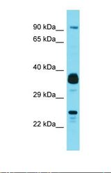Western blot of Human MCF7. JOSD1 antibody dilution 1.0 ug/ml.