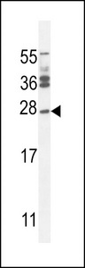 Western blot of lysates from HT-1080, A549 cell line (from left to right), using JOSD2 Antibody. Antibody was diluted at 1:1000 at each lane. A goat anti-rabbit IgG H&L (HRP) at 1:5000 dilution was used as the secondary antibody. Lysates at 35ug per lane.