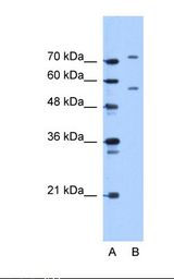 Lane A: Marker. Lane B: Jurkat cell lysate. Antibody concentration: 5.0 ug/ml. Gel concentration: 12%.