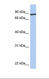 Hela cell lysate. Antibody concentration: 1.0 ug/ml. Gel concentration: 12%.