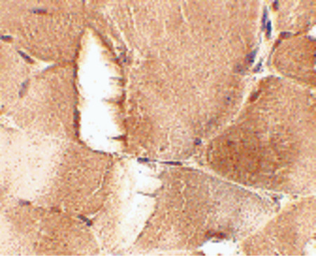 Immunohistochemistry of JPH1 in mouse skeletal muscle tissue with JPH1 antibody at 2.5 ug/ml.