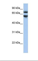 HepG2 cell lysate. Antibody concentration: 1.0 ug/ml. Gel concentration: 12%.