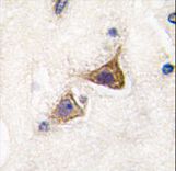 Formalin-fixed and paraffin-embedded human brain tissue reacted with Junctophilin 3 Antibody , which was peroxidase-conjugated to the secondary antibody, followed by DAB staining. This data demonstrates the use of this antibody for immunohistochemistry; clinical relevance has not been evaluated.