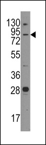Western blot of anti-Junctophilin 3 antibody in mouse brain tissue lysates (35 ug/lane). Junctophilin 3(arrow) was detected using the purified antibody.