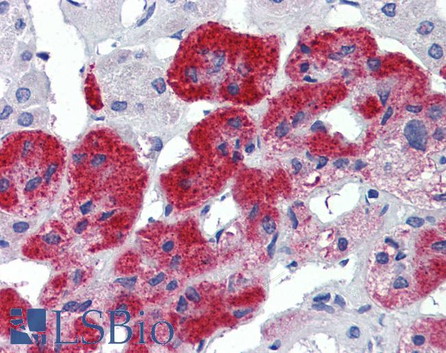 Anti-JPH3 antibody IHC of human adrenal. Immunohistochemistry of formalin-fixed, paraffin-embedded tissue after heat-induced antigen retrieval. Antibody LS-B3876 concentration 5 ug/ml.