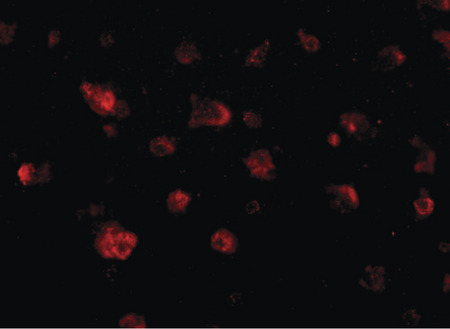 Immunofluorescence of JPH3 in human brain tissue with JPH3 antibody at 20 ug/ml.