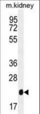 GPX3 Antibody western blot of mouse kidney tissue lysates (35 ug/lane). The GPX3 antibody detected the GPX3 protein (arrow).