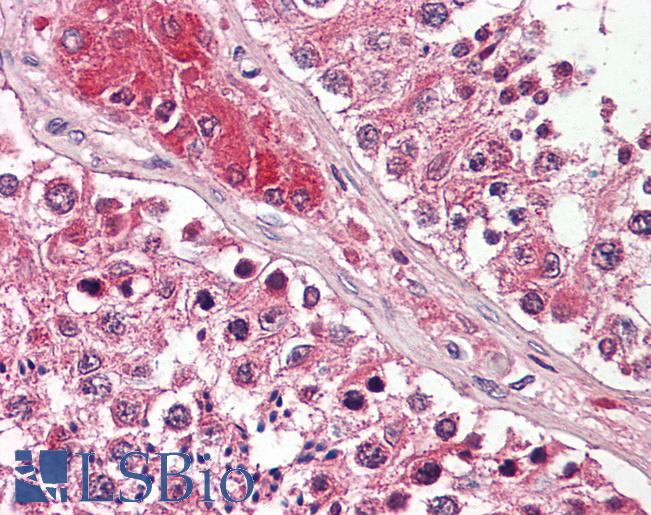 Anti-GPX4 / MCSP antibody IHC of human testis. Immunohistochemistry of formalin-fixed, paraffin-embedded tissue after heat-induced antigen retrieval. Antibody LS-B7835 dilution 1:200.