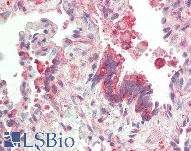 Anti-JUN / c-Jun antibody IHC staining of human lung. Immunohistochemistry of formalin-fixed, paraffin-embedded tissue after heat-induced antigen retrieval. Antibody LS-B10358 concentration 10 ug/ml.