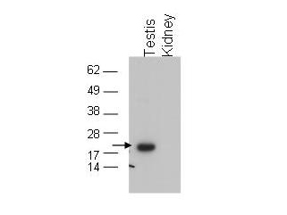 Anti-GPx4 Antibody - Western Blot. Western blot of affinity purified anti-GPx4 to detect GPx4 in testis extract (arrow). tissue extract (40 ug) was electrophoresed and transferred to nitrocellulose. The membrane was probed with the primary antibody at a 1:1000 dilution. Personal Communication, Dolph Hatfield, CCR-NCI, Bethesda, MD.