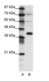 A: Marker, B: 293T Cell Lysate