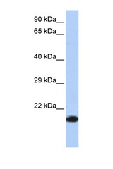 GPX4 antibody LS-B4687 Western blot of HepG2 Cell lysate. Antibody concentration 1 ug/ml.