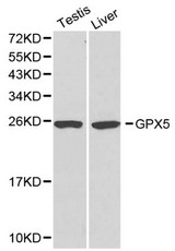 Western blot of GPX5 pAb in extracts from mouse testis and liver tissues.