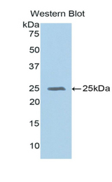 Western blot of recombinant GPX5.