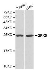 Western blot analysis of testis cell and liver cell lysate using GPX5 antibody.