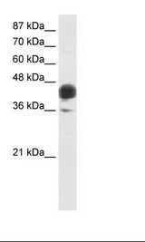 Transfected 293T Cell Lysate