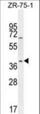 JUNB Antibody western blot of ZR-75-1 cell line lysates (35 ug/lane). The JUNB antibody detected the JUNB protein (arrow).