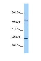 JDP2 antibody LS-C146028 Western blot of 3 Cell lysate. Antibody concentration 1 ug/ml.