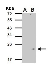Western blot of GPX7 expression in transfected 293T cell line by GPX7 polyclonal antibody. A: Non-transfected lysate., B: GPX7 transfected lysate. 12% SDS PAGE. GPX7 antibody diluted at 1:500