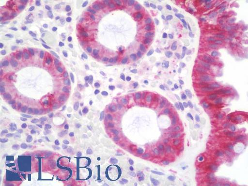 Anti-JUP/CTNNG/Junction Plakoglobin antibody IHC staining of human colon. Immunohistochemistry of formalin-fixed, paraffin-embedded tissue after heat-induced antigen retrieval. Antibody LS-B9801 concentration 5 ug/ml.