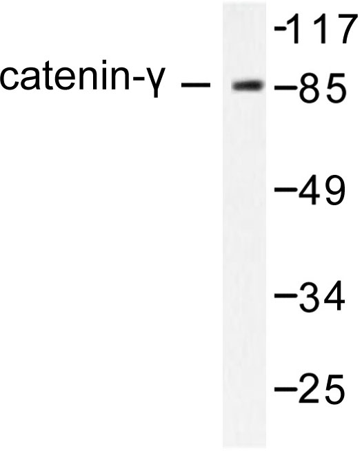 Western blot of Catenin-/PLAK (731) pAb in extracts from HeLa cells.