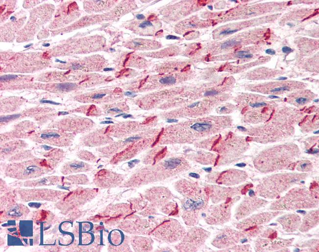 Anti-Gamma Catenin antibody IHC of human heart. Immunohistochemistry of formalin-fixed, paraffin-embedded tissue after heat-induced antigen retrieval. Antibody LS-B2204 concentration 5 ug/ml.