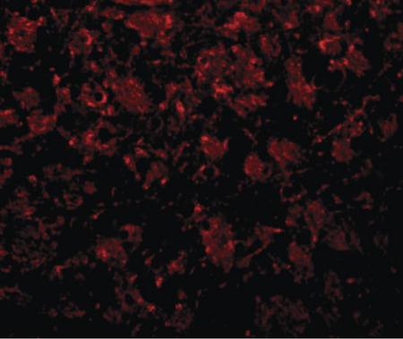 Immunofluorescence of GOLPH2 in rat brain tissue with GOLPH2 antibody at 20 ug/ml.