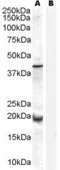 Antibody (0.3 ug/ml) staining of Human Prostate lysate (35 ug protein in RIPA buffer) with (B) and without (A) blocking with the immunizing peptide. Primary incubation was 1 hour. Detected by chemiluminescence.