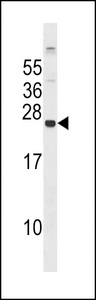 GPX8 Antibody western blot of 293 cell line lysates (35 ug/lane). The GPX8 antibody detected the GPX8 protein (arrow).