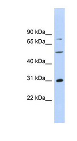 ASPH antibody LS-C115974 Western blot of MCF7 cell lysate.