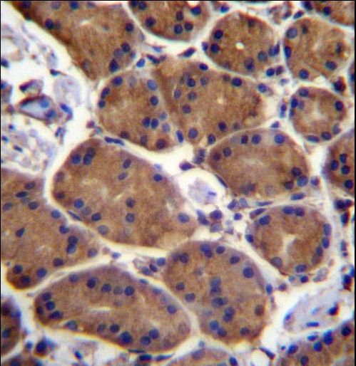 ASPH Antibody immunohistochemistry of formalin-fixed and paraffin-embedded human stomach tissue followed by peroxidase-conjugated secondary antibody and DAB staining.