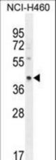 RAB3IL1 Antibody western blot of NCI-H460 cell line lysates (35 ug/lane). The RAB3IL1 antibody detected the RAB3IL1 protein (arrow).