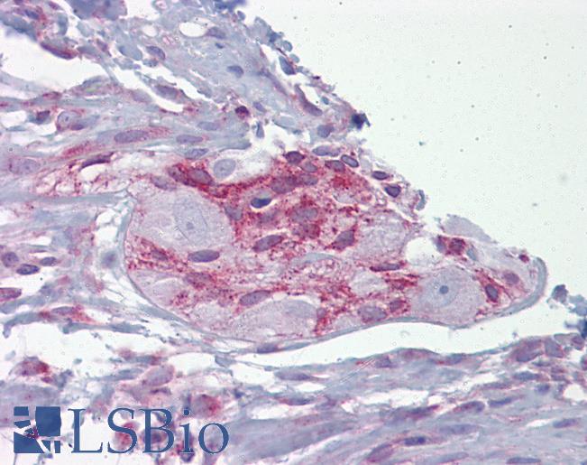 Anti-ASPH antibody IHC of human small intestine and myenteric plexus. Immunohistochemistry of formalin-fixed, paraffin-embedded tissue after heat-induced antigen retrieval. Antibody LS-B6602 concentration 5 ug/ml.