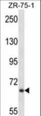 JPH2 Antibody western blot of ZR-75-1 cell line lysates (35 ug/lane). The JPH2 antibody detected the JPH2 protein (arrow).