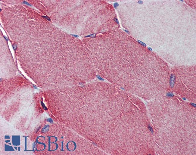 Anti-JPH2 antibody IHC of human skeletal muscle. Immunohistochemistry of formalin-fixed, paraffin-embedded tissue after heat-induced antigen retrieval. Antibody LS-B3874 concentration 5 ug/ml.