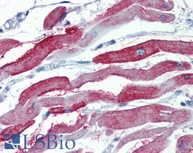 Anti-JPH2 antibody IHC of human heart. Immunohistochemistry of formalin-fixed, paraffin-embedded tissue after heat-induced antigen retrieval. Antibody LS-B3874 concentration 5 ug/ml.