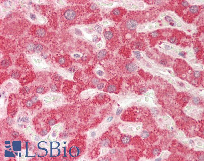 Human Liver: Formalin-Fixed, Paraffin-Embedded (FFPE)