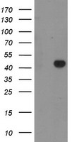 HEK293T cells were transfected with the pCMV6-ENTRY control (Left lane) or pCMV6-ENTRY RAB3IL1 (Right lane) cDNA for 48 hrs and lysed. Equivalent amounts of cell lysates (5 ug per lane) were separated by SDS-PAGE and immunoblotted with anti-RAB3IL1.