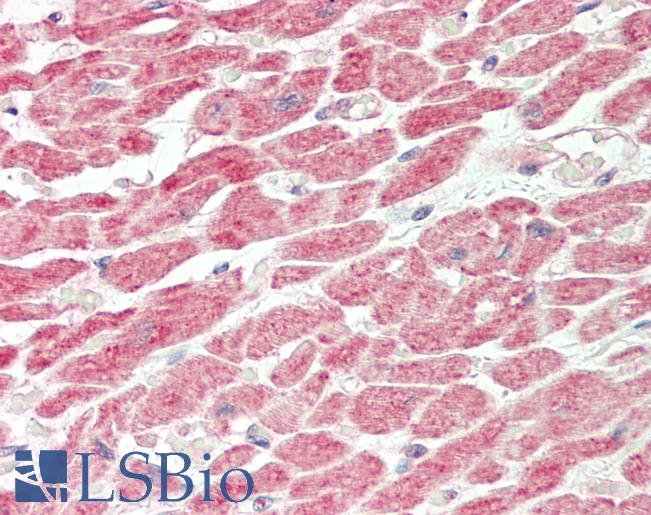 Human Heart: Formalin-Fixed, Paraffin-Embedded (FFPE)