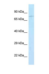 JPH2 antibody western blot of Mouse Pancreas lysate. Antibody concentration 1 ug/ml.