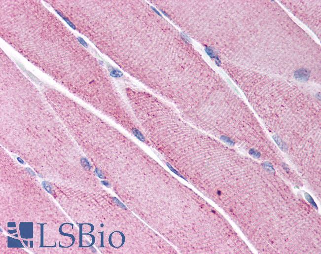 Anti-KCNG1 / Kv6.1 antibody IHC of human skeletal muscle. Immunohistochemistry of formalin-fixed, paraffin-embedded tissue after heat-induced antigen retrieval. Antibody LS-B974 concentration 5 ug/ml.