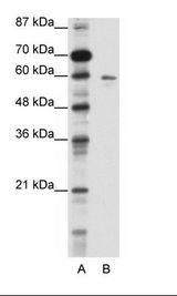 A: Marker, B: HepG2 Cell Lysate