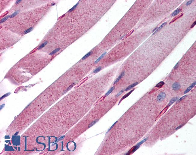 Anti-KALRN antibody IHC of human skeletal muscle. Immunohistochemistry of formalin-fixed, paraffin-embedded tissue after heat-induced antigen retrieval. Antibody LS-B137 concentration 5 ug/ml.