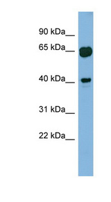 RAB3IL1 antibody LS-C107850 Western blot of Fetal Muscle lysate.