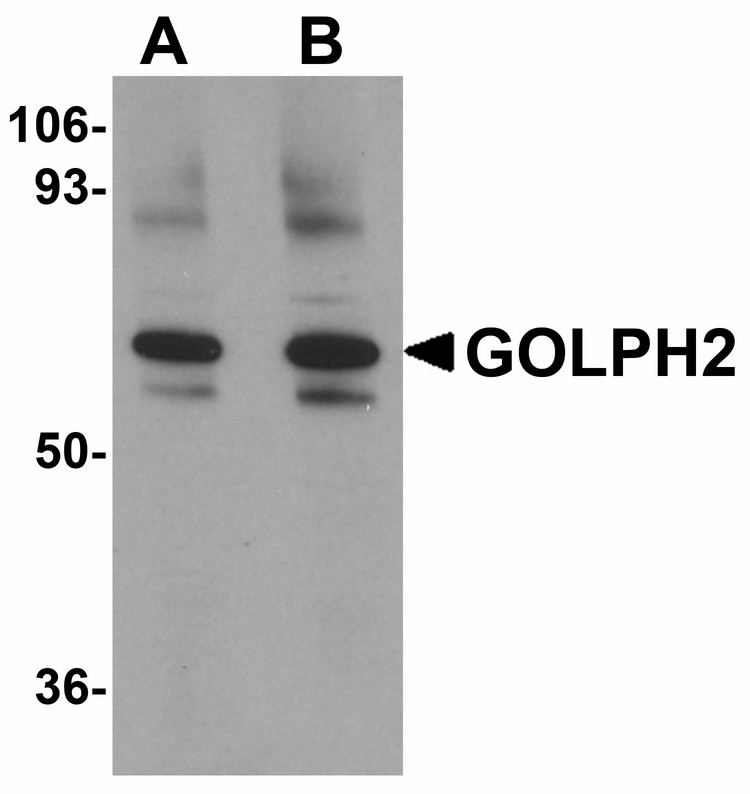 Western blot of GOLPH2 in rat brain tissue lysate with GOLPH2 antibody at (A) 0.25 and (B) 0.5 ug/ml.