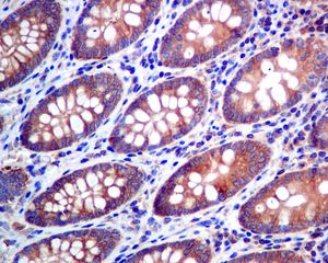 IHC of paraffin-embedded human colon tissue using anti-KARS antibody.