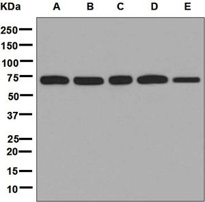 Western blot analysis on (A) Jurkat, (B) HeLa, (C) 293T, (D) HepG2, and (E) Caco-2 cell lysates using anti-KARS antibody.